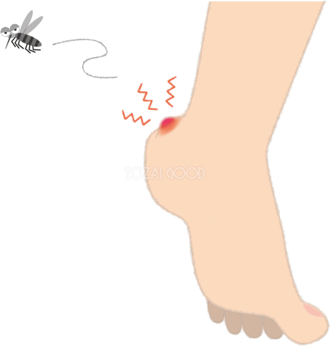 蚊に刺されて赤く腫れるカカトの無料イラスト/夏46977