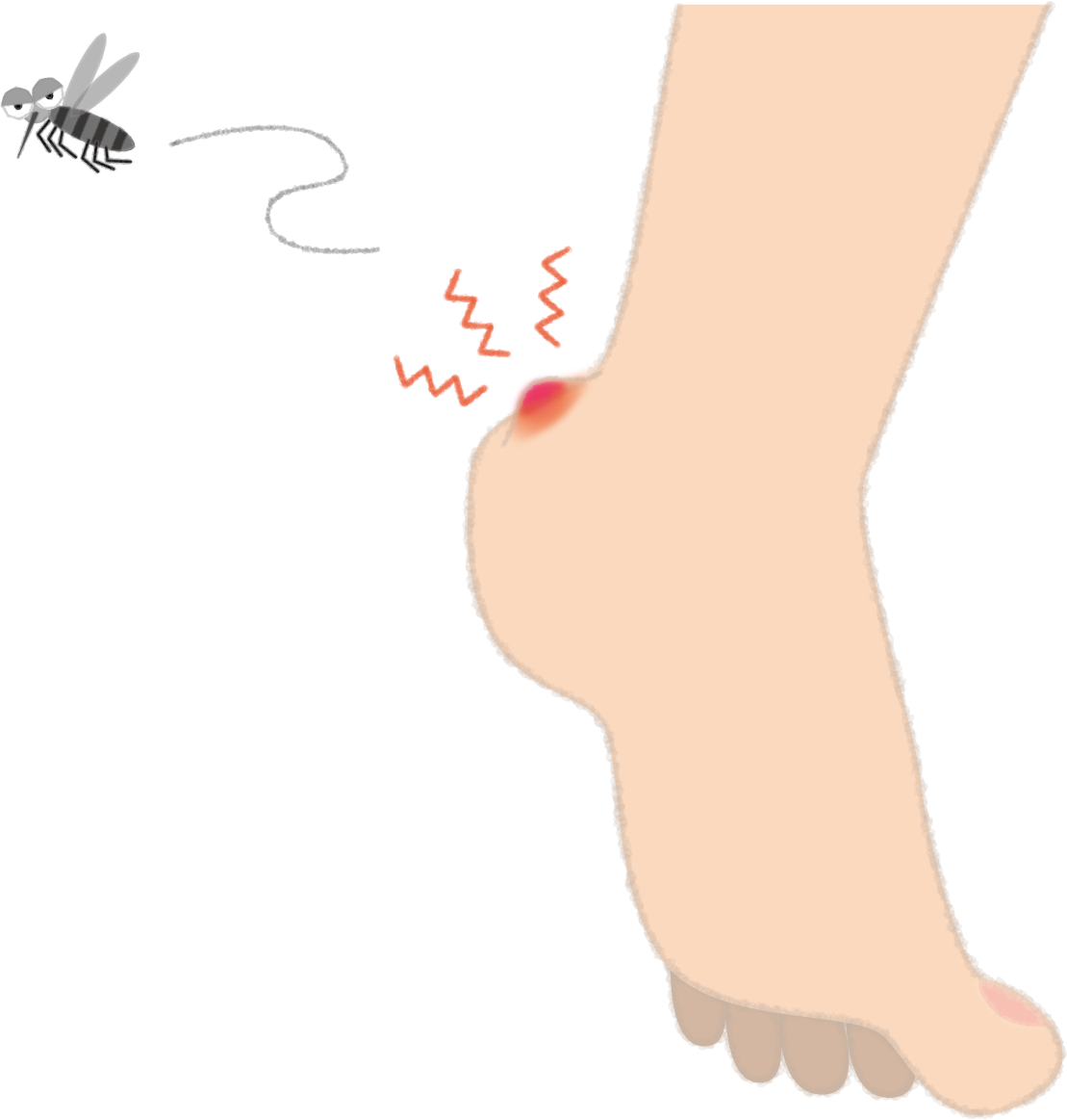 蚊に刺されて赤く腫れるカカトの無料イラスト／夏46977に写真・文字を入れる