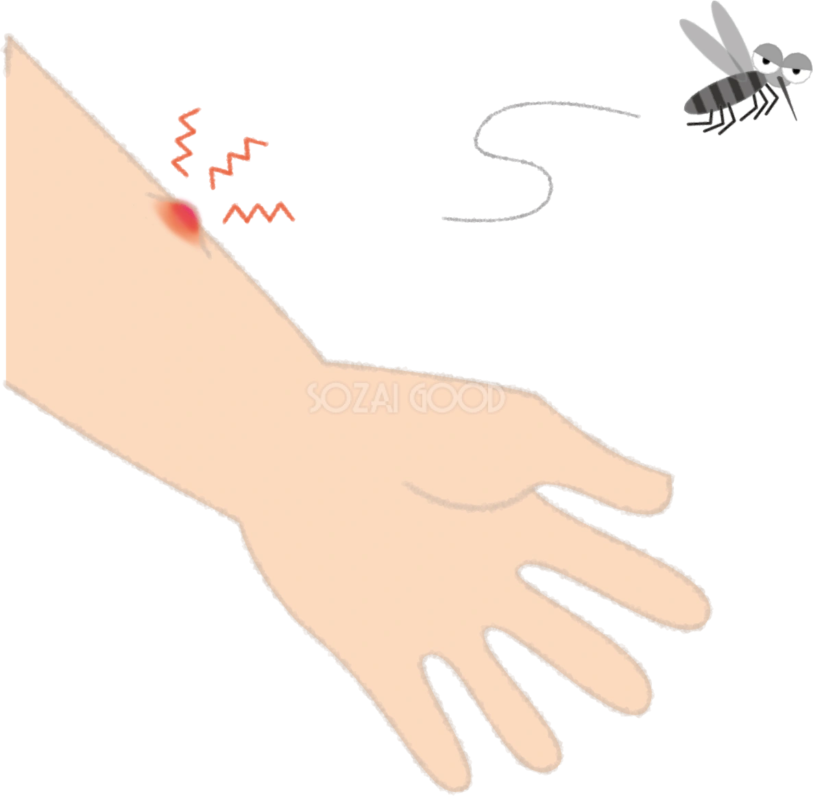 蚊に刺されて赤く腫れる腕の無料イラスト/夏46981