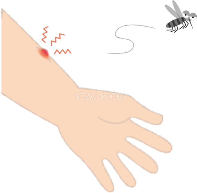 蚊に刺されて赤く腫れる腕の無料イラスト／夏46981 | 素材Good