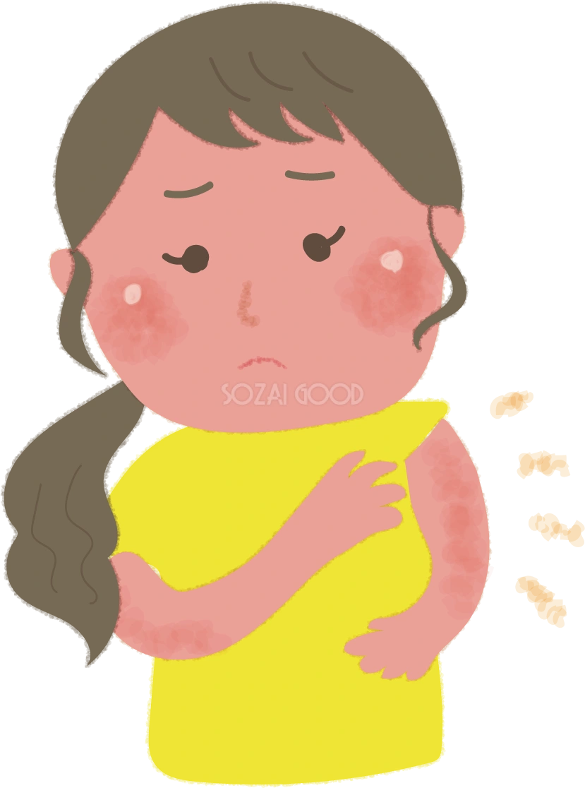 日焼けで肌を気にするかわいい女性の無料イラスト/海 プール48010
