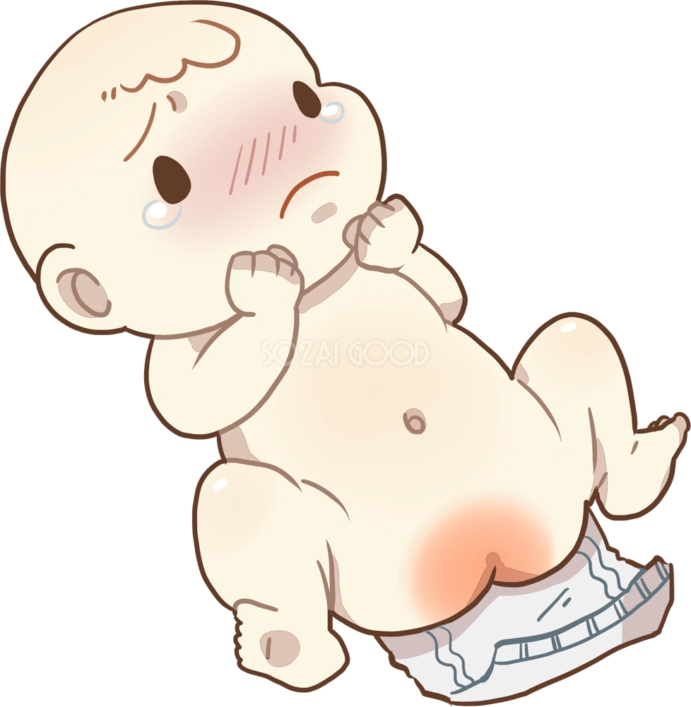 おしめを取った赤ちゃんのおしりが、かぶれて悲しそう 無料イラスト