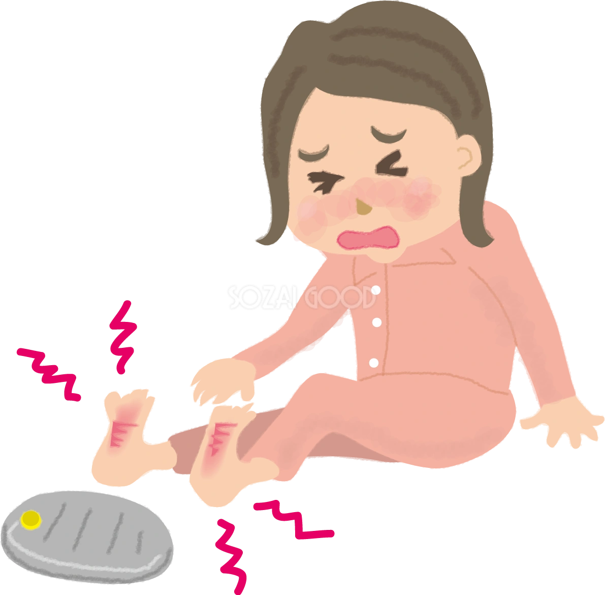 低温やけどした足の無料イラスト61116